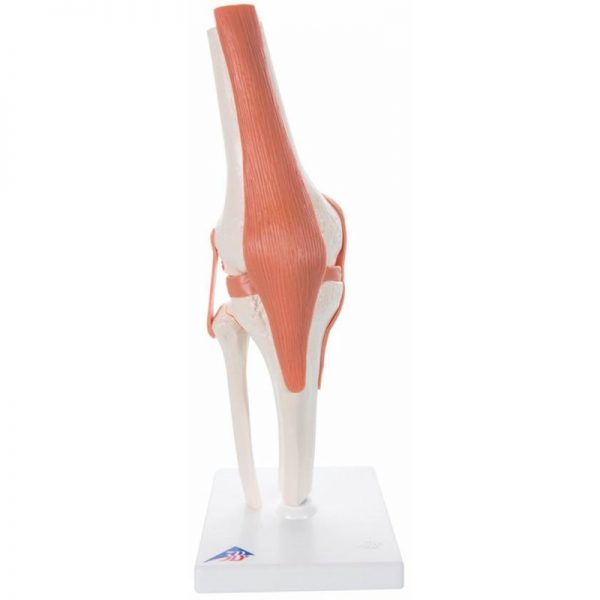 Model zgloba koljena - prednja bočna strana