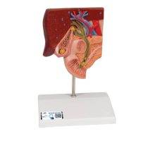 Model žučnog kamenca na postolju